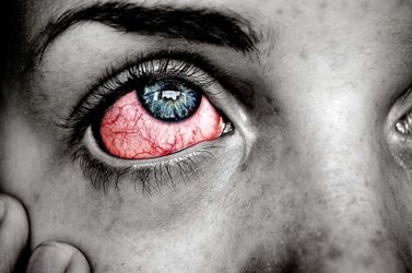 Ögoninflammation-när ska man söka vård